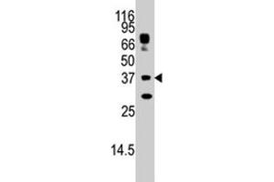 The STUB1 polyclonal antibody  is used in Western blot to detect STUB1 in HepG2 cell lysate. (STUB1 抗体  (AA 160-190))