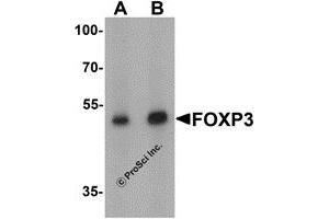 Western Blotting (WB) image for anti-Forkhead Box P3 (FOXP3) (C-Term) antibody (ABIN1077427) (FOXP3 抗体  (C-Term))