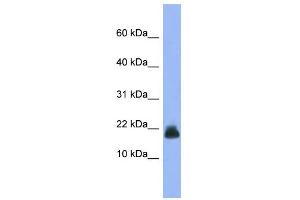WB Suggested Anti-Cst6 Antibody Titration: 0. (CST6 抗体  (Middle Region))