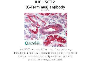 Image no. 1 for anti-SCO2 Cytochrome C Oxidase Assembly Protein (SCO2) antibody (ABIN1739069) (SCO2 抗体)