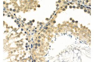 ABIN6261792 and ABIN6266895 at 1/100 staining Rat testis tissue by IHC-P. (FOXJ3 抗体  (C-Term))