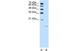 WB Suggested Anti-ACP1 Antibody Titration:  1. (ACP1 抗体  (N-Term))