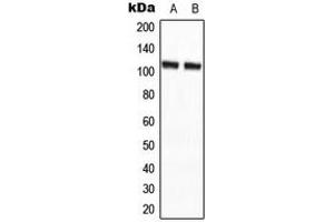 Western blot analysis of CCP2 expression in HepG2 (A), NIH3T3 (B) whole cell lysates. (AGBL2 抗体  (C-Term))