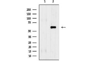 anti-ELK1, Member of ETS Oncogene Family (ELK1) (pSer383) antibody