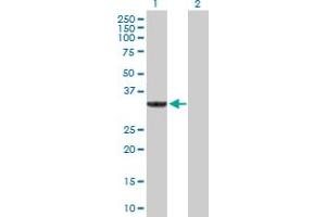 Western Blot analysis of SULT1A3 expression in transfected 293T cell line by SULT1A3 MaxPab polyclonal antibody. (SULT1A3 抗体  (AA 1-295))