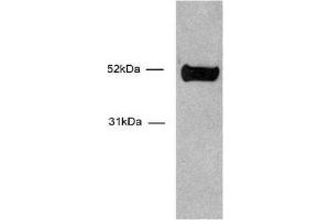 HNF-3α / FOXA1 antibody (mAb) tested by Western blot. (FOXA1 抗体  (AA 7-103))