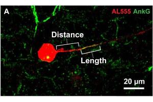 Representative image of Alexa 555 (AL555, red) dye-filled RGC labeled for the axon initial segment (AIS) scaffolding protein ankyrin-G (AnkG, cat.