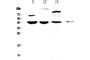 Western blot analysis of IL18 binding protein using anti-IL18 binding protein antibody . (IL18BP 抗体  (AA 29-193))