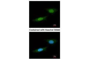 ICC/IF Image Immunofluorescence analysis of paraformaldehyde-fixed HeLa, using NLK, antibody at 1:100 dilution. (Nemo-Like Kinase 抗体)