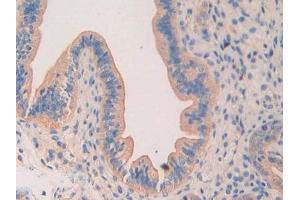 Used in DAB staining on fromalin fixed paraffin- embedded testis tissue (LAMa4 抗体  (AA 457-630))