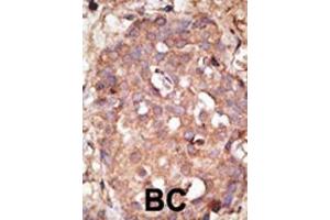 Immunohistochemistry (Paraffin-embedded Sections) (IHC (p)) image for anti-Negative Regulator of Ubiquitin-Like Proteins 1 (NUB1) (AA 513-542), (C-Term) antibody (ABIN389079)