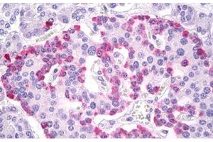 Anti-Glucagon antibody IHC of human pancreas, islets of Langerhans. (Glucagon 抗体  (AA 25-54))