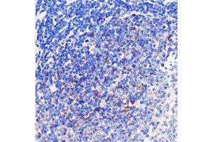 Immunohistochemistry (IHC) image for anti-Tumor Necrosis Factor Receptor Superfamily, Member 9 (TNFRSF9) (AA 150-250) antibody (ABIN7271073)