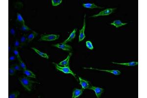 Immunofluorescent analysis of Hela cells using ABIN7147190 at dilution of 1:100 and Alexa Fluor 488-congugated AffiniPure Goat Anti-Rabbit IgG(H+L) (CD9 抗体  (AA 112-195))