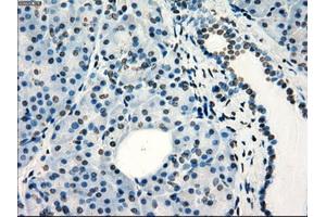 Immunohistochemical staining of paraffin-embedded colon tissue using anti-FRKmouse monoclonal antibody. (FRK 抗体)