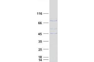 Validation with Western Blot