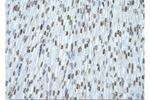 Rabbit Anti-HNRNPAB Antibody       Paraffin Embedded Tissue:  Human cardiac cell   Cellular Data:  Epithelial cells of renal tubule  Antibody Concentration:   4. (HNRNPAB 抗体  (C-Term))