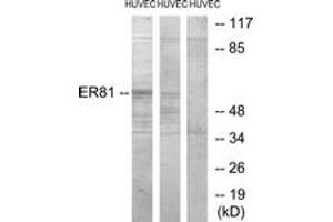 Western blot analysis of extracts from HuvEc cells, treated with PMA 125ng/ml 30', using ER81 Antibody. (ETV1 抗体  (AA 10-59))