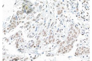Immunohistochemistry (IHC) image for anti-Protein BANP (BANP) (C-Term) antibody (ABIN7453906) (BANP 抗体  (C-Term))