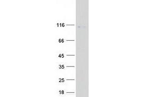 Western Blotting (WB) image for ADAM Metallopeptidase with thrombospondin Type 1 Motif, 8 (ADAMTS8) protein (Myc-DYKDDDDK Tag) (ABIN2714389)