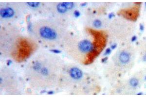 IHC-P analysis of Liver tissue, with DAB staining. (SLC30A8 抗体  (AA 1-80))