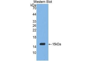 WB of Protein Standard: different control antibodies against Highly purified E. (Myeloperoxidase ELISA 试剂盒)