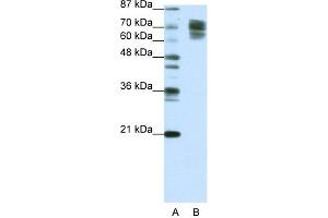 WB Suggested Anti-CTNNB1 Antibody Titration:  1.