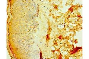 Immunohistochemistry of paraffin-embedded human skin tissue using ABIN7156848 at dilution of 1:100 (IL2 Receptor beta 抗体  (AA 48-177))