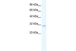 WB Suggested Anti-CLIC2 Antibody Titration:  1. (CLIC2 抗体  (C-Term))