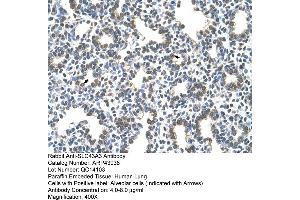 Human Lung (SLC43A3 抗体  (N-Term))
