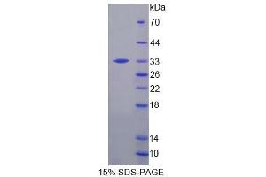 SDS-PAGE analysis of Mouse CNP Protein. (Cnpase 蛋白)