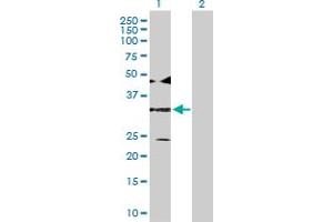 Western Blotting (WB) image for anti-Activating Transcription Factor 4 (Tax-Responsive Enhancer Element B67) (ATF4) (AA 1-351) antibody (ABIN513571)