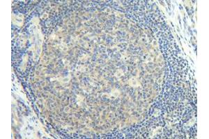 Image no. 3 for anti-Interleukin 2 (IL2) antibody (ABIN181648) (IL-2 抗体)