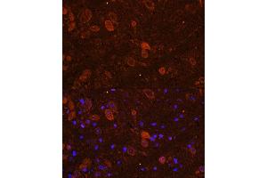 Immunofluorescence analysis of NIH/3T3 cells using FGF17 Rabbit pAb (ABIN7267183) at dilution of 1:150 (40x lens). (FGF17 抗体  (AA 23-180))