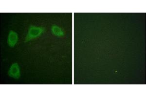 Immunofluorescence analysis of HuvEc cells, using Caveolin-1 antibody. (Caveolin-1 抗体)