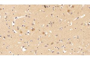 Detection of ADPN in Human Cerebrum Tissue using Polyclonal Antibody to Adiponectin (ADPN) (ADIPOQ 抗体  (AA 108-244))