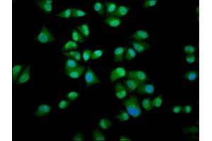 Immunofluorescence staining of Hela cells with ABIN7156289 at 1:200, counter-stained with DAPI. (IMPDH1 抗体  (AA 191-281))