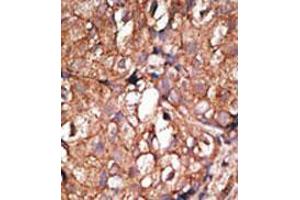 Image no. 2 for anti-5'-Nucleotidase, Ecto (CD73) (NT5E) (C-Term) antibody (ABIN357390) (CD73 抗体  (C-Term))