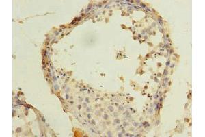 Immunohistochemistry of paraffin-embedded human testis tissue using ABIN7143124 at dilution of 1:100 (ARPM1 抗体  (AA 1-372))