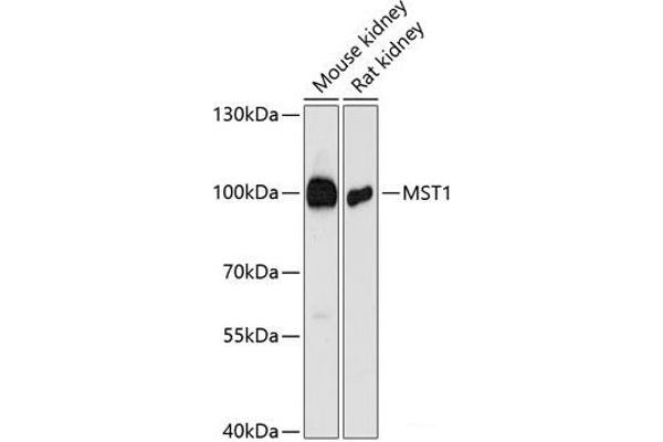 MST1 anticorps