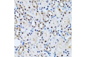 Immunohistochemistry of paraffin-embedded rat kidney using CCAR2 antibody (ABIN2563550) at dilution of 1:100 (40x lens). (CCAR2 抗体)