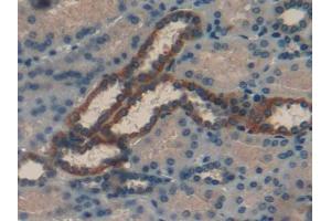DAB staining on IHC-P; Samples: Human Kidney Tissue (RBP1 抗体  (AA 2-135))