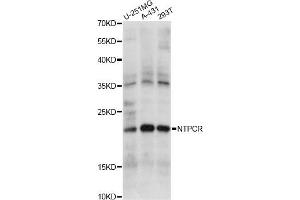 Western blot analysis of extracts of various cell lines, using NTPCR antibody. (C1orf57 抗体)