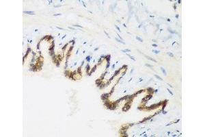 Immunohistochemistry of paraffin-embedded Rat lung using KIAA1456 Polyclonal Antibody at dilution of 1:200 (40x lens). (KIAA1456 抗体)