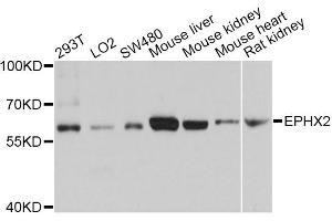 Western blot analysis of extracts of various cell lines, using EPHX2 antibody (ABIN5970967) at 1/1000 dilution. (EPHX2 抗体)