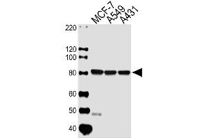 Lane 1: MCF-7 Cell lysates, Lane 2: A549 Cell lysates, Lane 3: A431 Cell lysates, probed with CAPN1 (1376CT809. (CAPNL1 抗体)