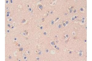 Detection of HEXb in Human Cerebrum Tissue using Polyclonal Antibody to Hexosaminidase B Beta (HEXb) (HEXB 抗体  (AA 122-311))