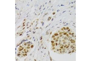 Immunohistochemistry (Paraffin-embedded Sections) (IHC (p)) image for anti-Nuclear Autoantigenic Sperm Protein (Histone-Binding) (NASP) (AA 180-449) antibody (ABIN6144374)