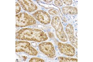 Immunohistochemistry of paraffin-embedded rat kidney using RPL4 Rabbit pAb (ABIN6129106, ABIN6147145, ABIN6147146 and ABIN6221591) at dilution of 1:100 (40x lens). (RPL4 抗体  (AA 1-240))