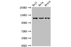 Western Blot Positive WB detected in: Raji whole cell lysate, Hela whole cell lysate, Mouse brain tissue All lanes: KIF11 antibody at 3. (KIF11 抗体  (AA 920-1038))